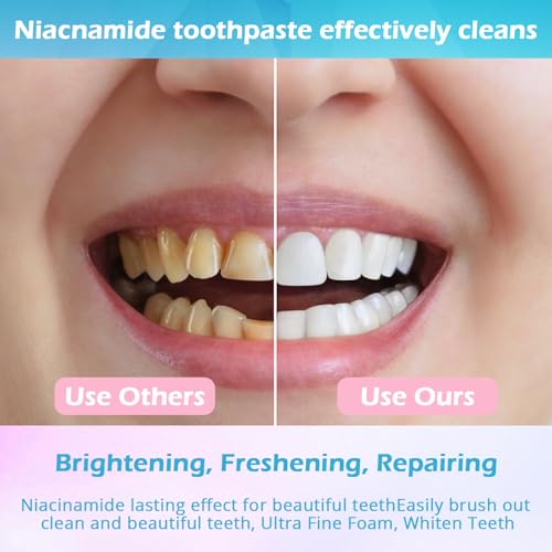 Niacinamide Whitening Toothpaste, Niacinamide Toothpaste Intensive Whitens Teeth, Protects Enamel, Removes Stains & Refreshes Breath, Daily Oral Care at Home Mint Flavor (1)